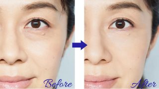 目の下の薄い茶色の気になってたシミが確実に薄くなりました！　嬉しいご報告