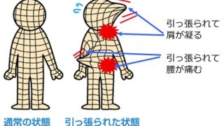ボルボレッタのディープ筋膜リリースについて